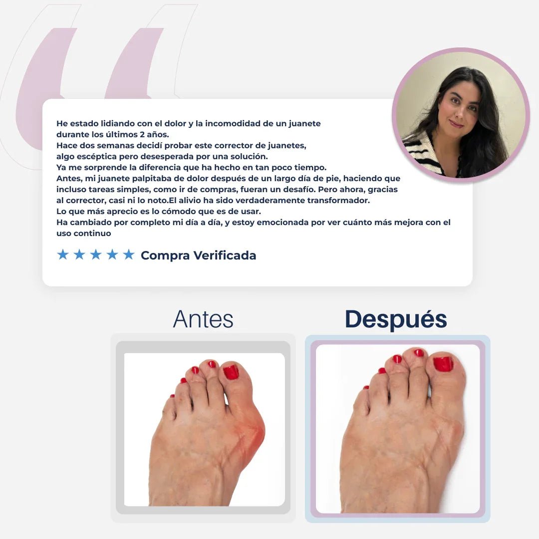 AliviFlex™️ – Acelera la alineación de tus juanetes mientras duermes - SereniVida Mexico