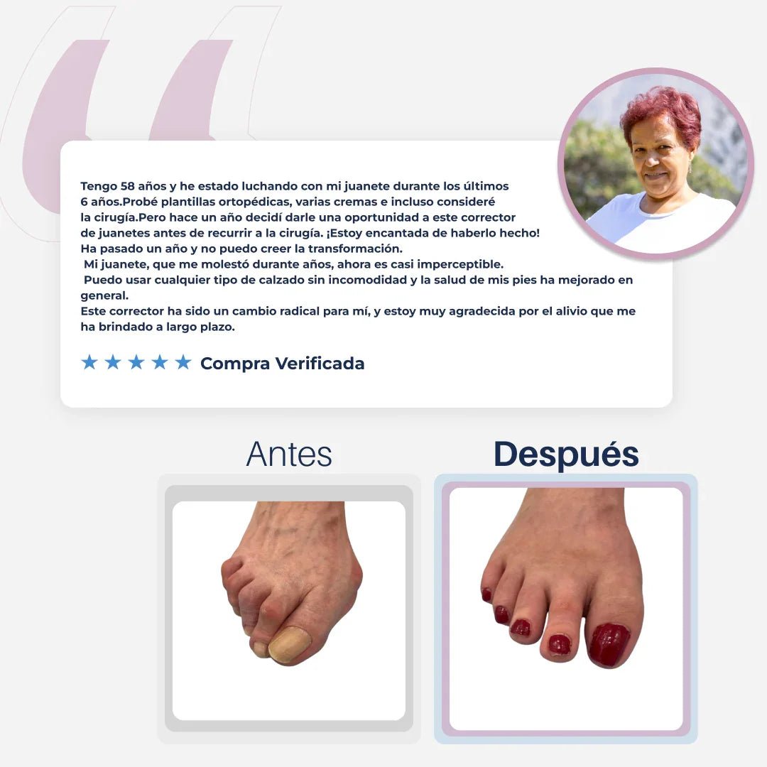 AliviFlex™️ – Acelera la alineación de tus juanetes mientras duermes - SereniVida Mexico